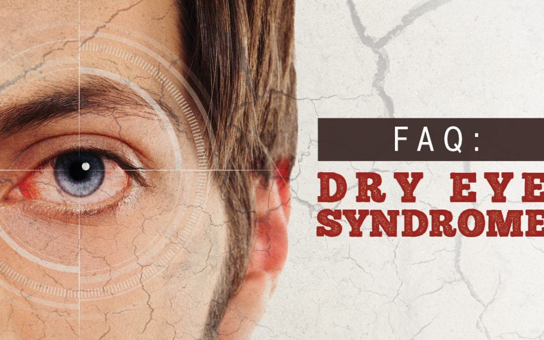 FAQ: Dry Eye Syndrome